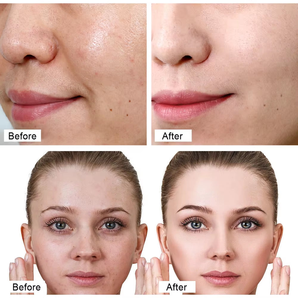 30G Retinol Face Cream Anti-Wrinkle Anti-Aging Moisturizing Hyaluronic Acid Facial Cream Skin Care Face Brightening Creams